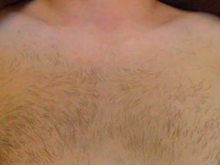 胸毛脱毛効果 脱毛前