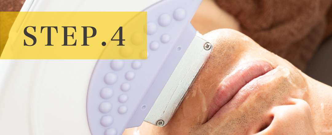 鼻下ひげ脱毛step4